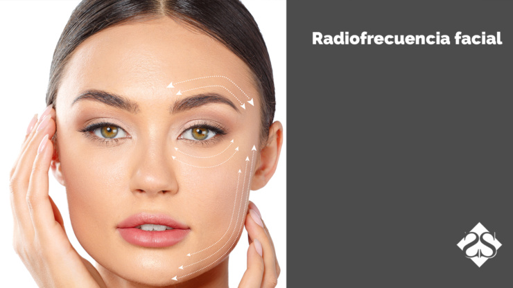 Radiofrecuencia facial